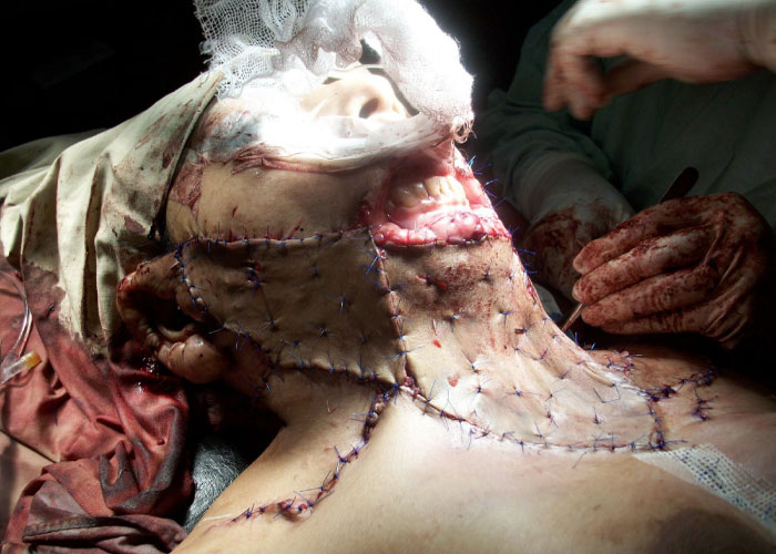 General Surgery